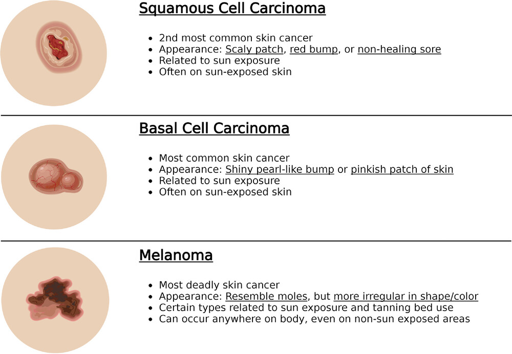 Figure 1. Overview of the three most common skin cancers. Illustration created with Biorender.com.