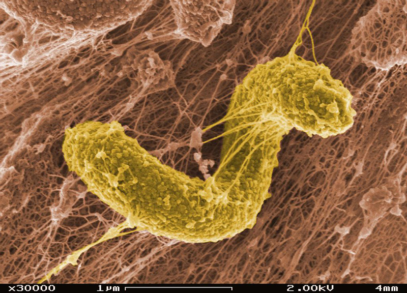 Scanning electron microscope image of Desulfovibrio desulfuricans.