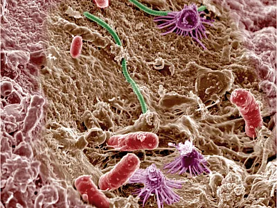 Soil microbes. Image courtesy of Pacific Northwest National Laboratory. Reprinted here under this license: https://creativecommons.org/ licenses/by-nc-sa/2.0/