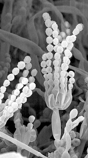 Each teaspoonful of healthy soil contains billions of soil microorganisms like the soil fungus seen here. Photo courtesy of USDAâARS, Electron & Confocal Microscopy Unit, Beltsville, MD.