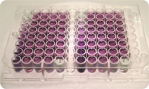 Quantification of extracted soil protein through absorbance. Photo courtesy of Steve Culman.